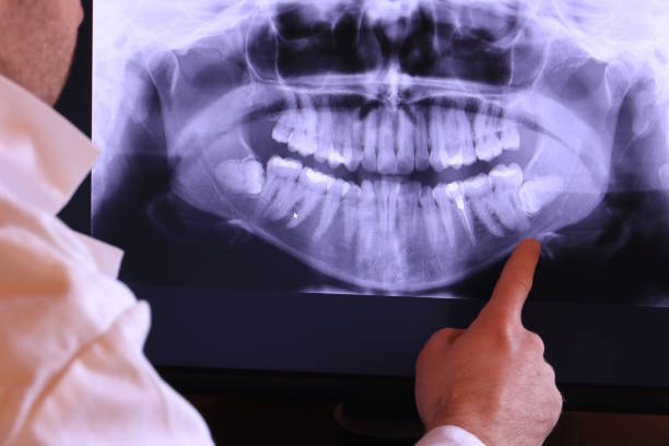 Best Emergency Tooth Extraction in Westminster, CA