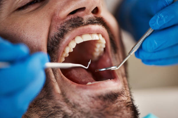 Best Emergency Gum Treatment in Westminster, CA