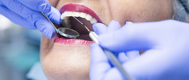 Best Emergency Tooth Extraction in Westminster, CA